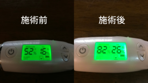 ビフォーアフター